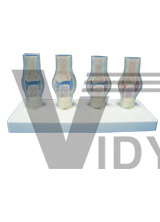 The model of knee joint pathology